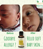 Babycare Kit