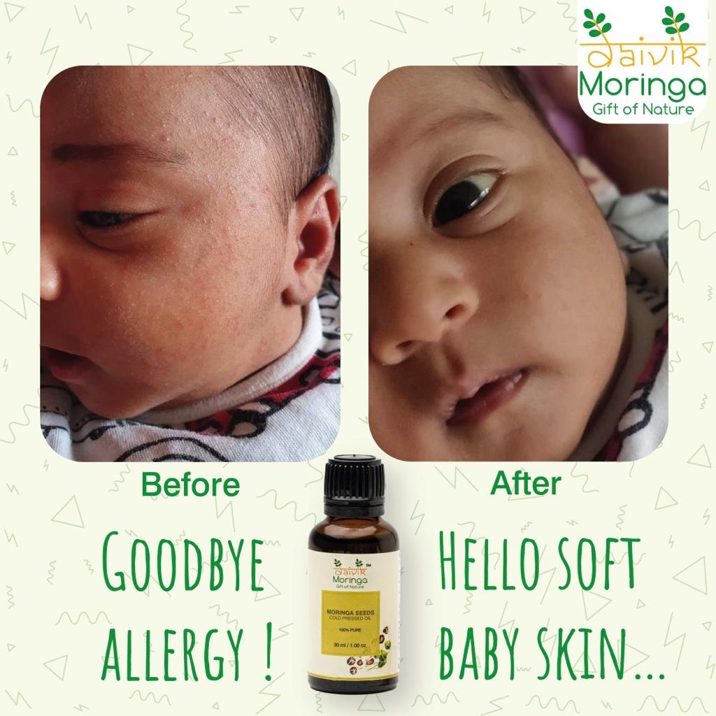 Babycare Kit